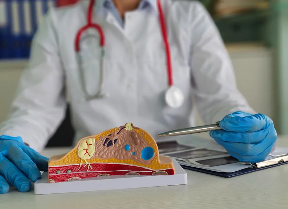 Doktor objašnjava fibroadenom koristeći model tkiva dojke