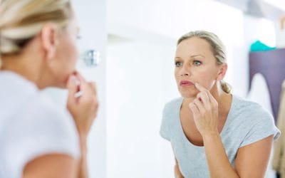 Hormonske akne u perimenopauzi i menopauzi: zašto se javljaju baš sada i šta stvarno pomaže